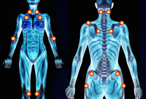 Fibromyalgia Columbus